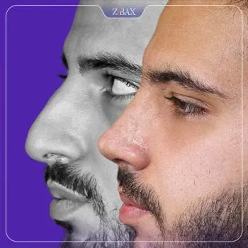 نمونه عمل جراحی بینی دکتر مریم بحری — تصویر 6