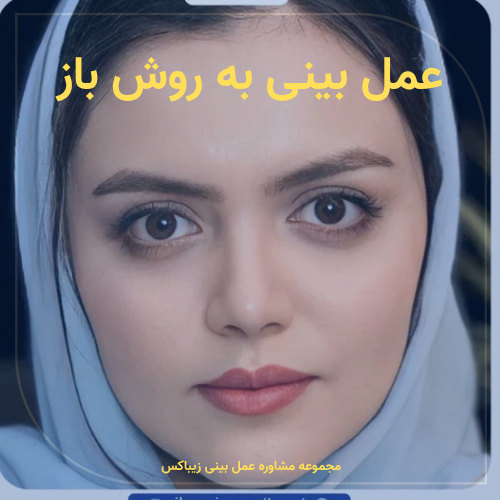عمل بینی به روش باز، مجموعه زیباکس