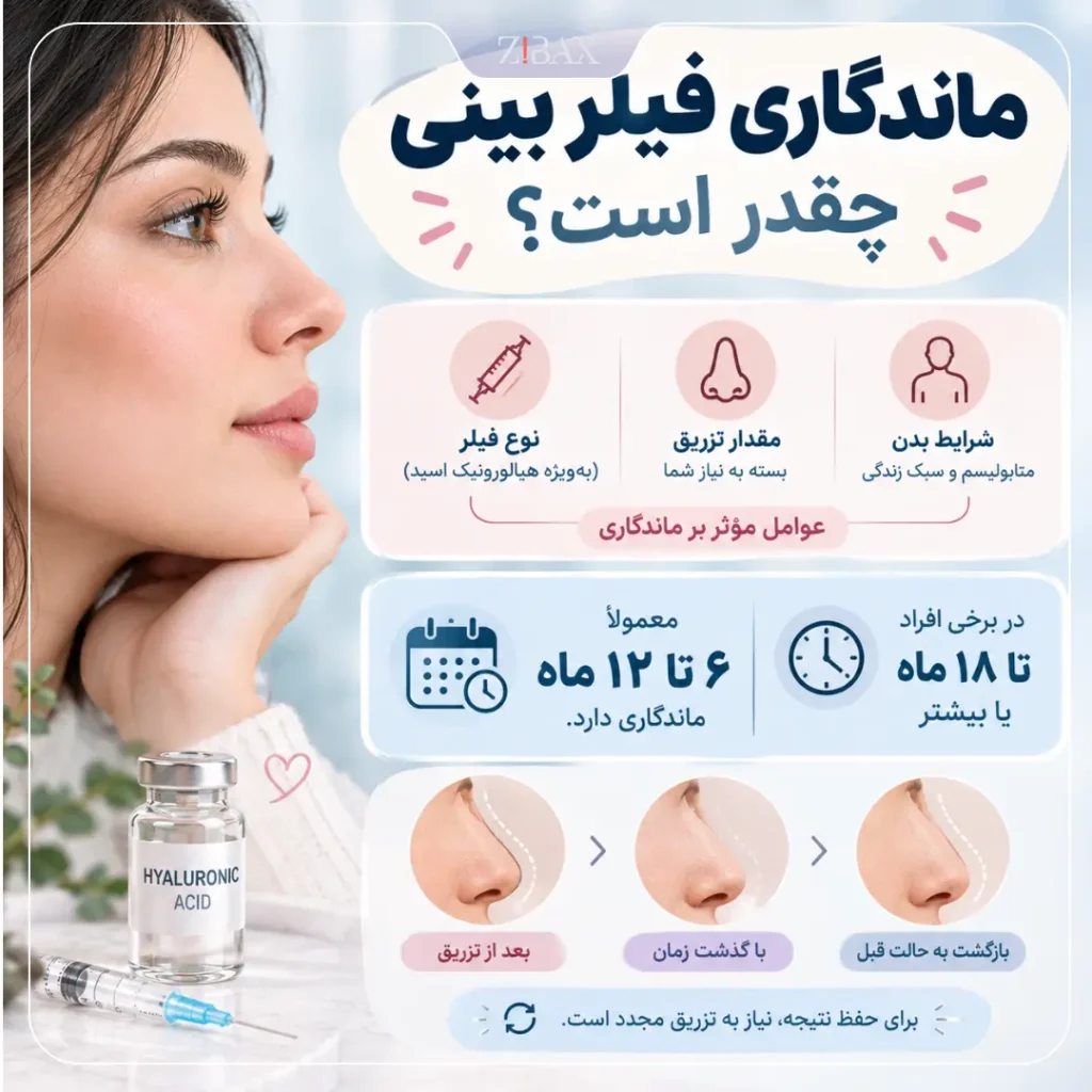 ماندگاری فیلر بینی