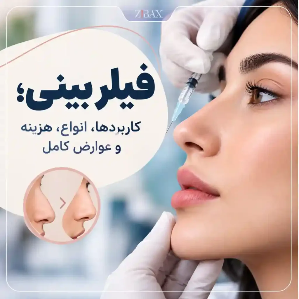 فیلر بینی