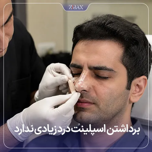 میزان درد برداشتن اسپلینت بینی