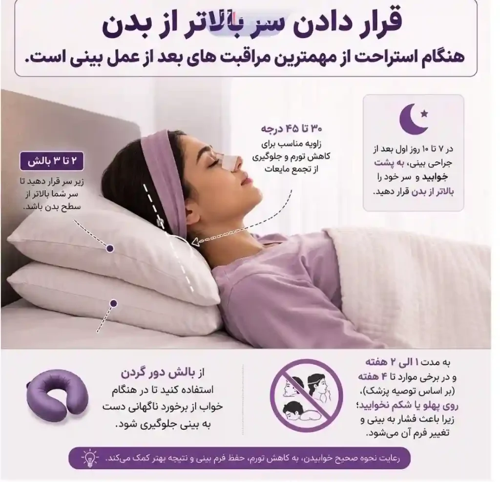 نحوه خوابیدن از مراقبت های بعد از جراحی بینی