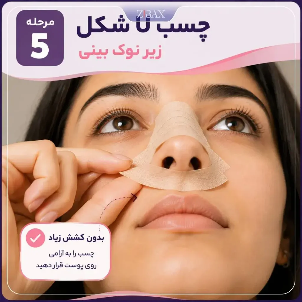 قرار دادن چسب U شکل زیر نوک بینی بعد از عمل
