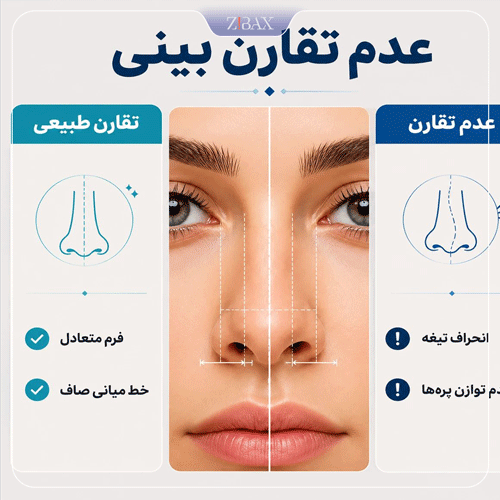 اینفوگرافی عدم تقارن بینی یکی از عوارض جراحی زیبایی بینی