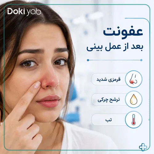 اینفوگرافی علائم عفونت بعد از عمل بینی؛ شامل قرمزی شدید، ترشح چرکی و تب