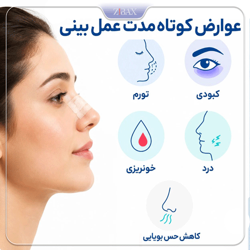 اینفوگرافی عوارض کوتاه مدت عمل بینی؛ کبودی، تورم، درد، خونریزی خفیف و کاهش حس بویایی