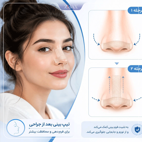 تصویر شماتیک آموطش چسب زدن بینی برای جلوگیری از عوارض رینوپلاستی