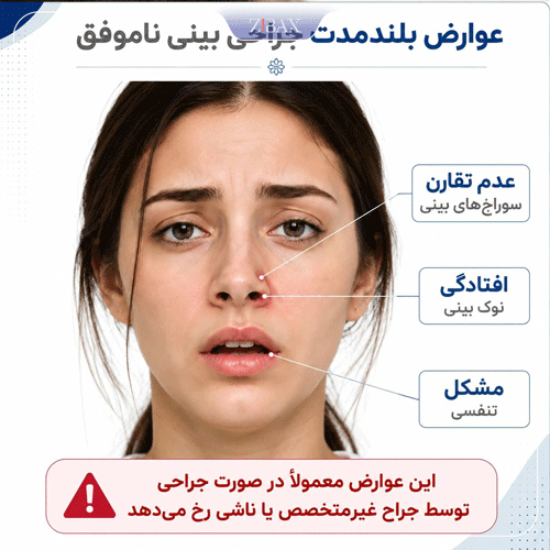 عوارض بلندمدت جراحی بینی ناموفق با جراح ناشی، شامل عدم تقارن سوراخ‌ها، مشکلات تنفسی و افتادگی نوک بینی