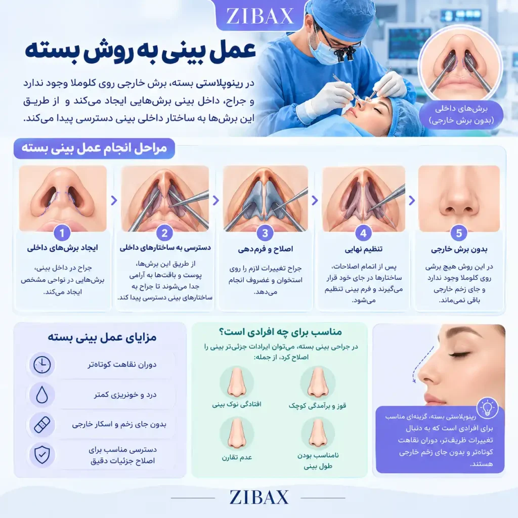 عمل بینی بسته