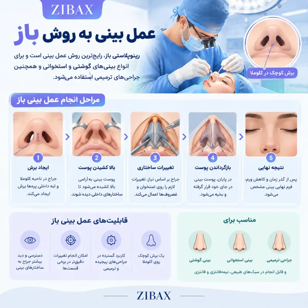 عمل بینی باز