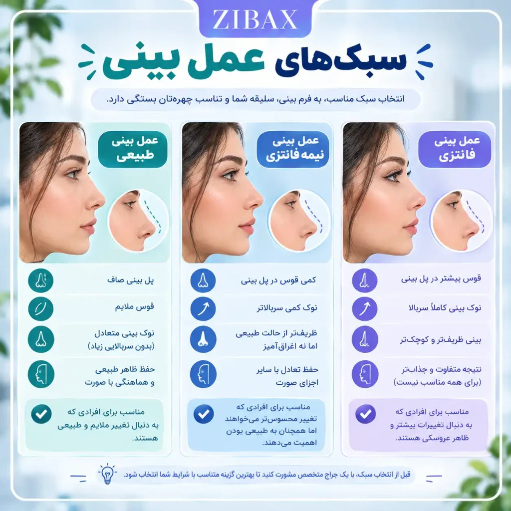 سبک های مختلف رینو