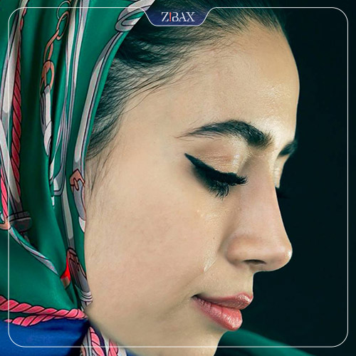 نمونه عمل جراحی بینی دکتر حمیدرضا کریمی — تصویر 10
