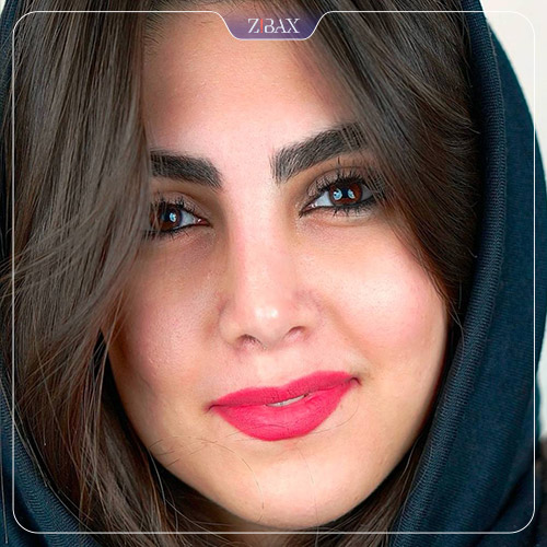 نمونه عمل جراحی بینی دکتر حمیدرضا کریمی — تصویر 8