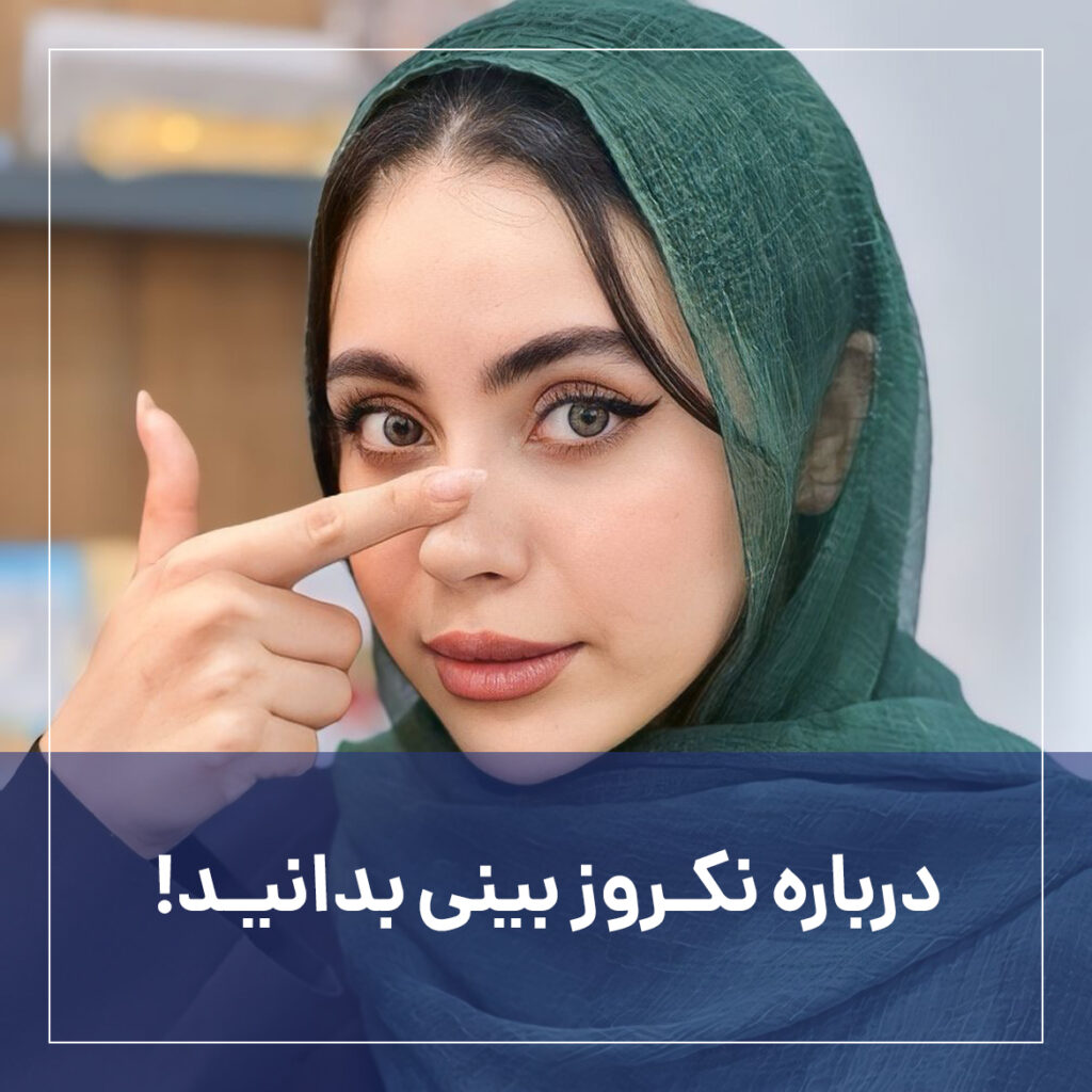 نکروز بینی