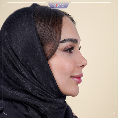 قوس ملایم در عمل بینی نیمه فانتزی با تیم زیباکس