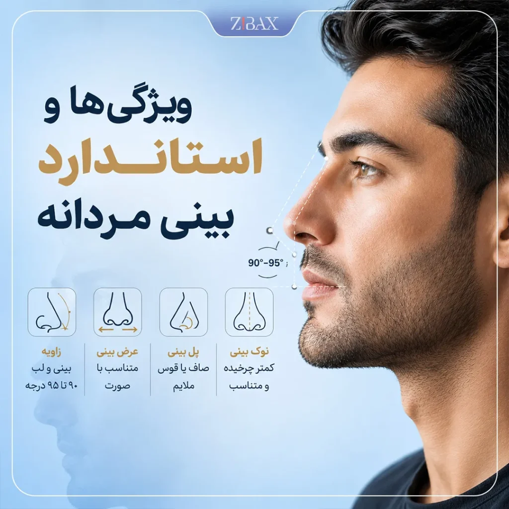 ویژگی های مدل بینی مردانه