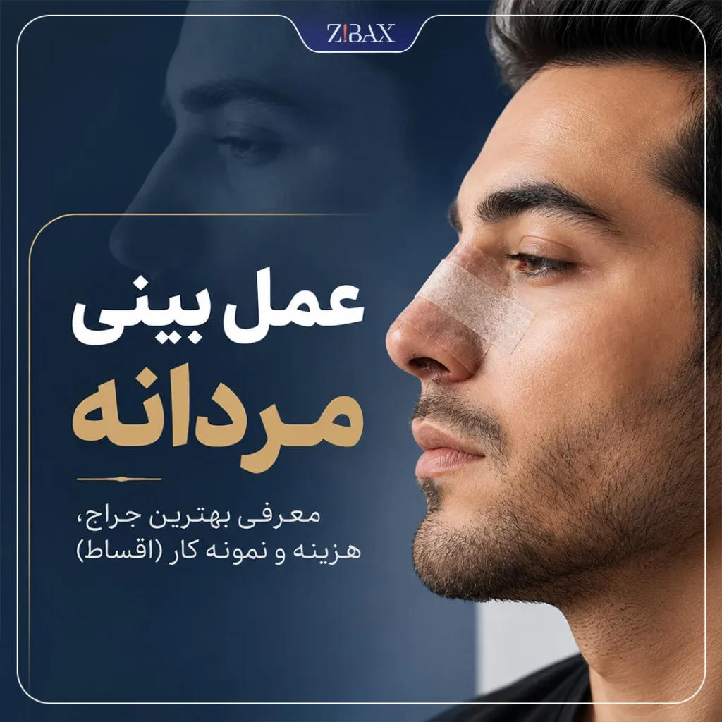 عمل بینی مردانه