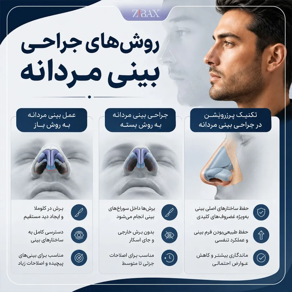 روش های عمل بینی پسرانه