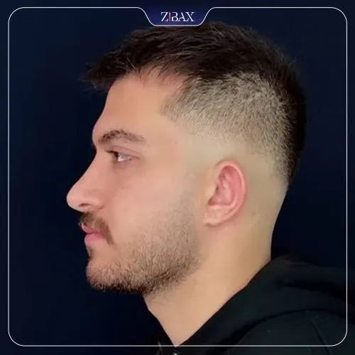 عکس عمل بینی طبیعی مردانه