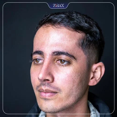 عکس عمل بینی طبیعی مردانه