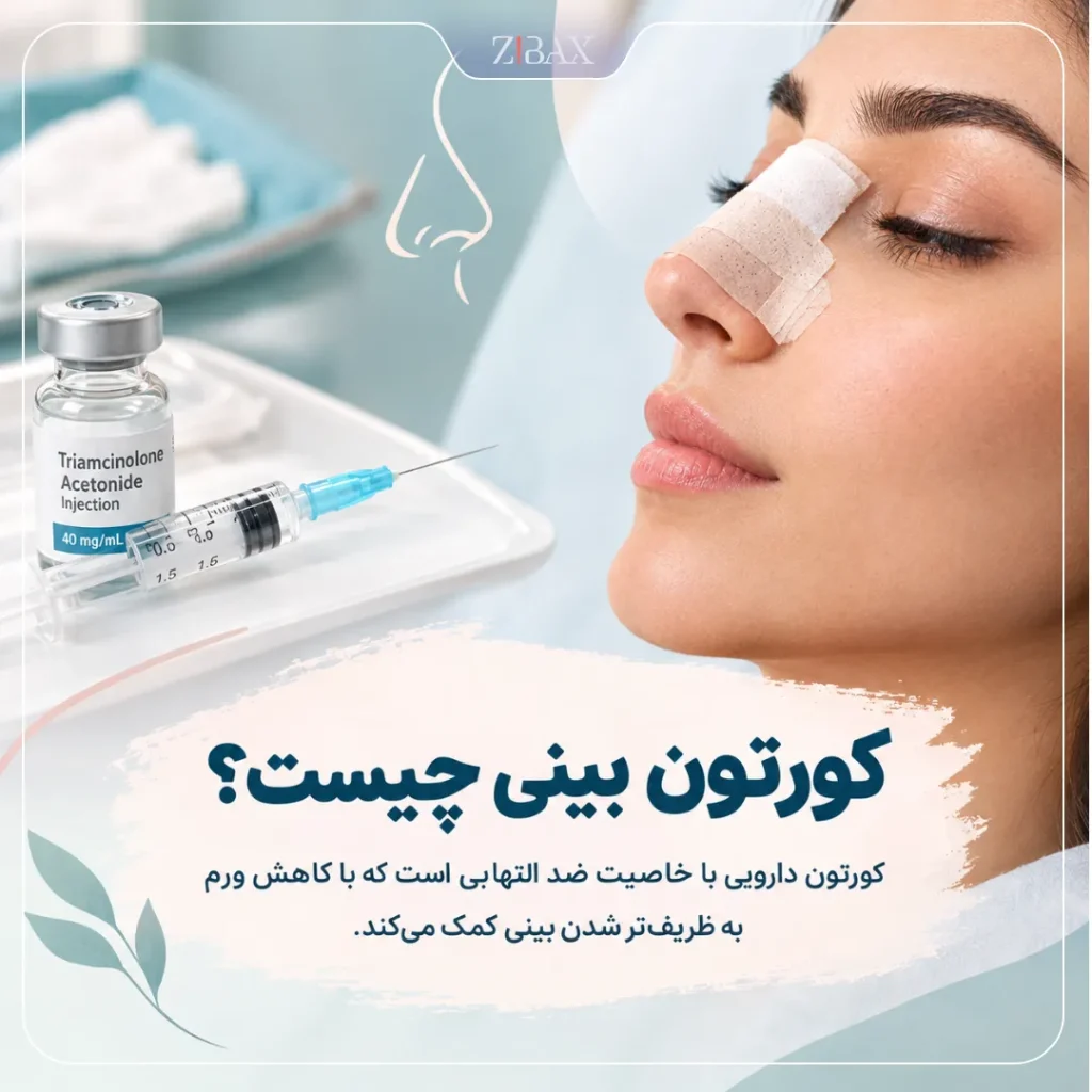 کورتون بینی چیست