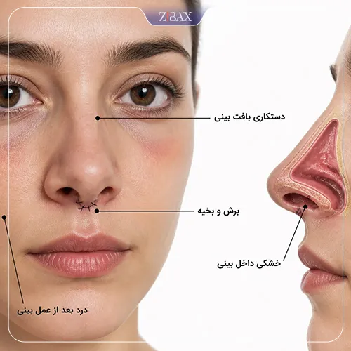 بررسی دلایل ایجاد درد بعد از عمل بینی