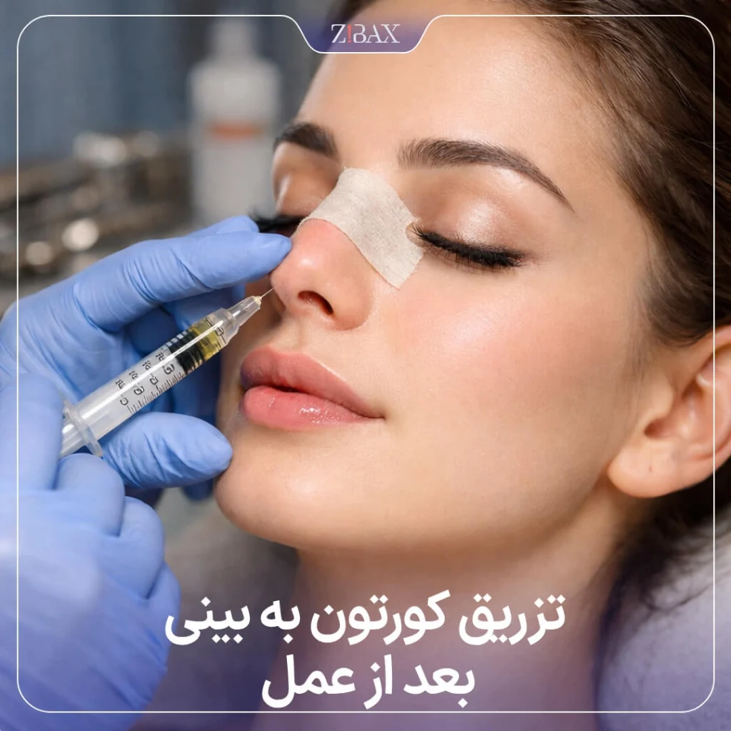 تصویری از دست پزشک در حال تزریق کورتون بعد از عمل بینی به بینی خانم