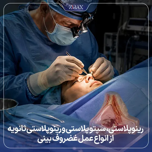 روش‌ها و تکنیک‌های جراحی غضروف بینی