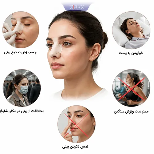 راهکارهای پیشگیری از جابجایی غضروف بینی بعد رینوپلاستی
