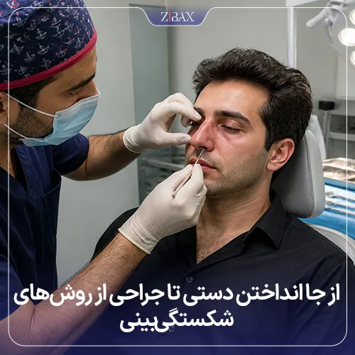 بررسی روشهای درمان شکستگی بینی