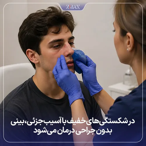 شکستگیهای بینی بدون نیاز به عمل