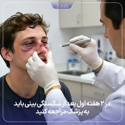 زمان مراجعه به پزشک بعد از شکستگی بینی
