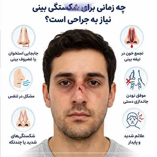 زمان نیاز به عمل شکستگی بینی