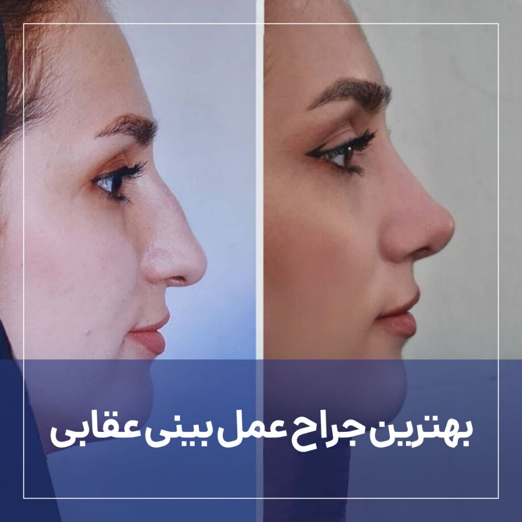 بهترین جراح بینی عقابی؛ مجموعه زیباکس