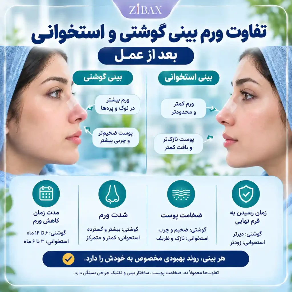 ورم بینی گوشتی و استخوانی