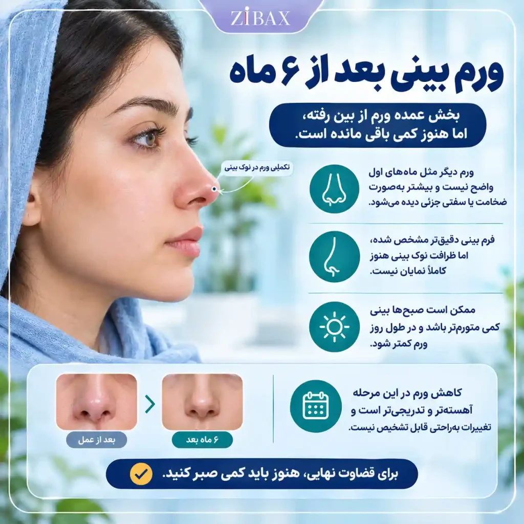 ورم بینی بعد از ۶ ماه