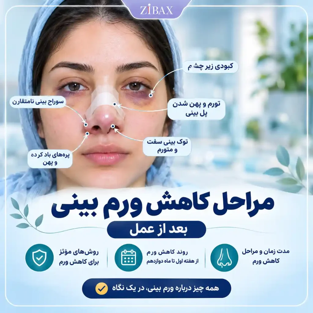 مراحل کاهش ورم بینی بعد از عمل