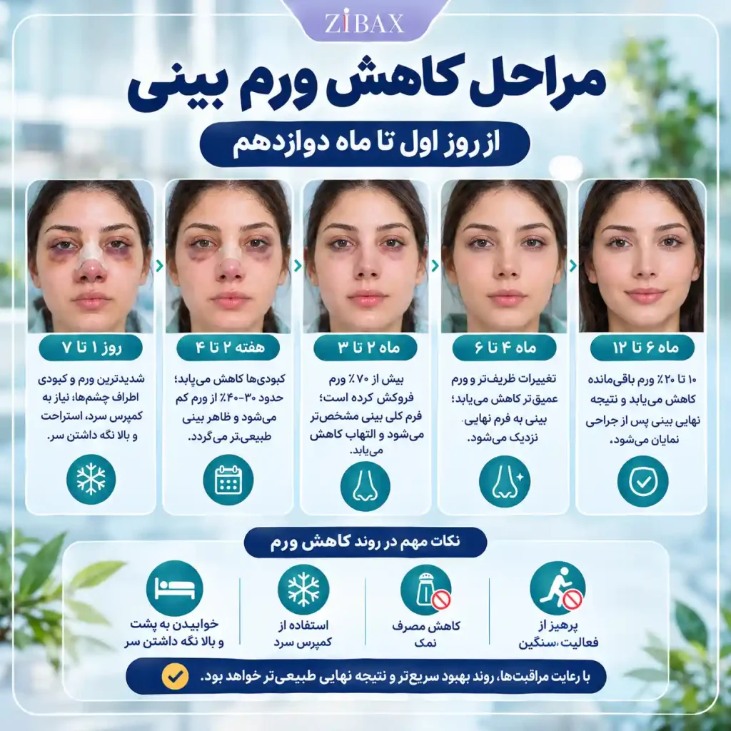 مراحل کاهش ورم بینی