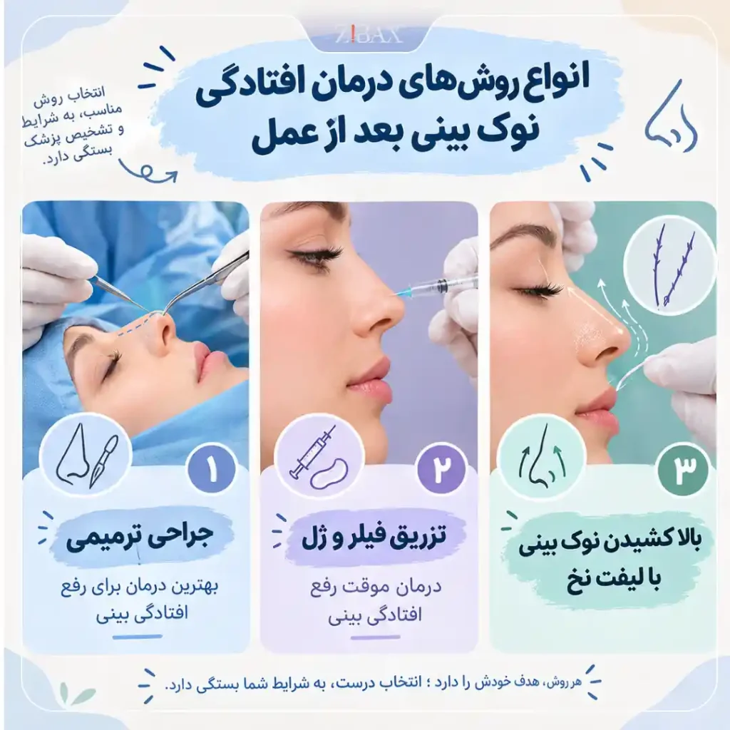 درمان افتادگی نوک بینی بعد از عمل