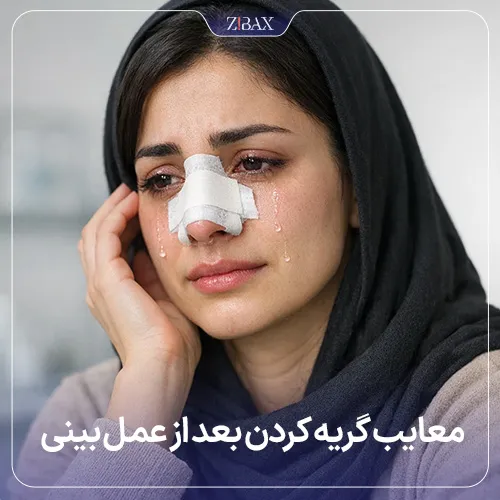 عوارض گریه کردن بعد از رینوپلاستی