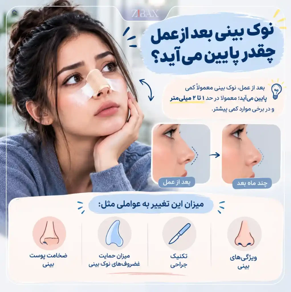 پایین اوردن نوک بینی