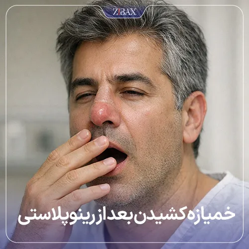 معایب و دلیل ممنوع بودن خمیازه بعداز عمل بینی