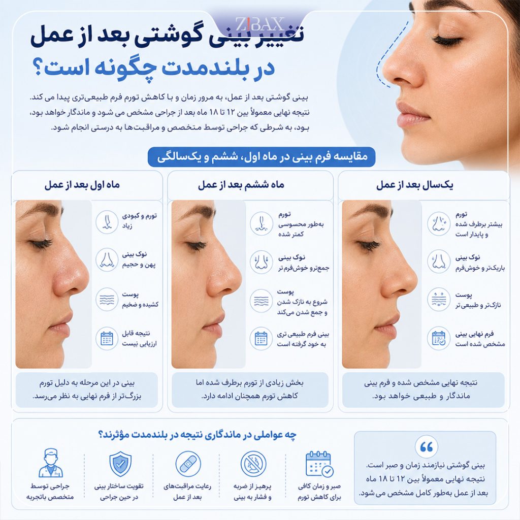 تغییر بینی گوشتی بعد از عمل در بلندمدت