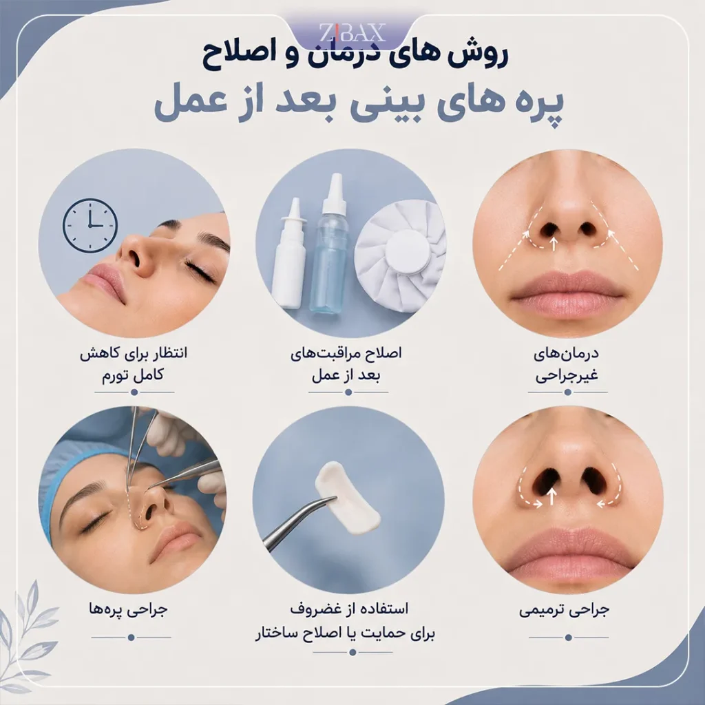 اصلاح پره های بینی بعد از عمل