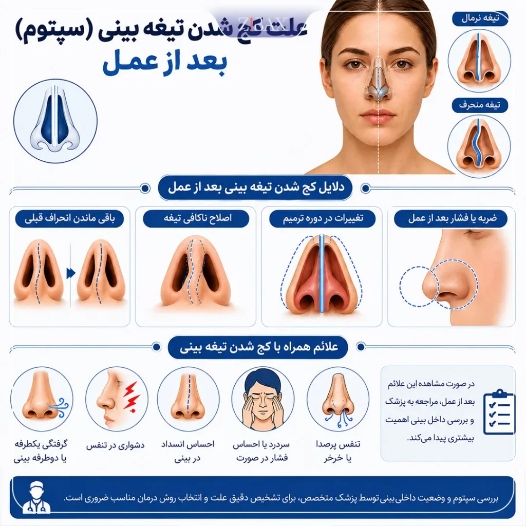 علت کج شدن تیغه بینی بعد از عمل