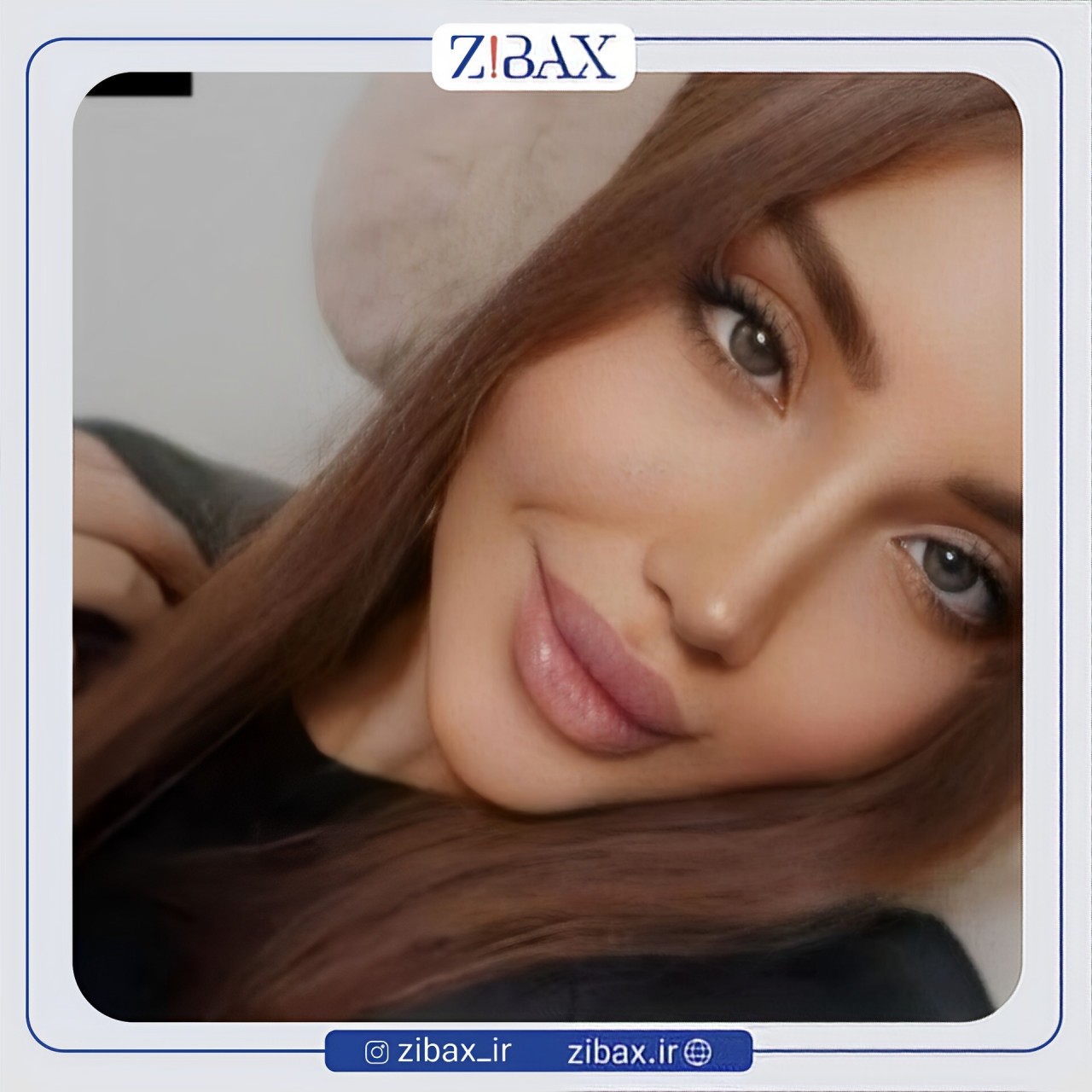 نمونه عمل جراحی بینی دکتر کامبیز پوریوسف — تصویر 5