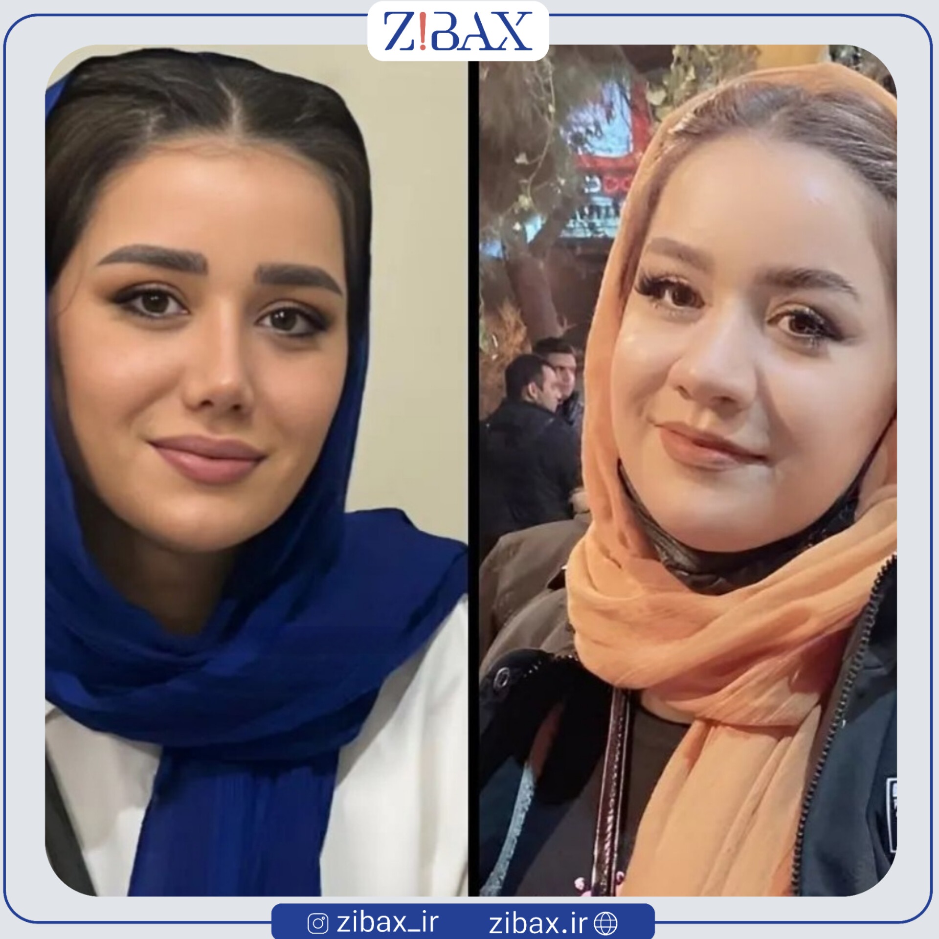 نتیجه جراحی