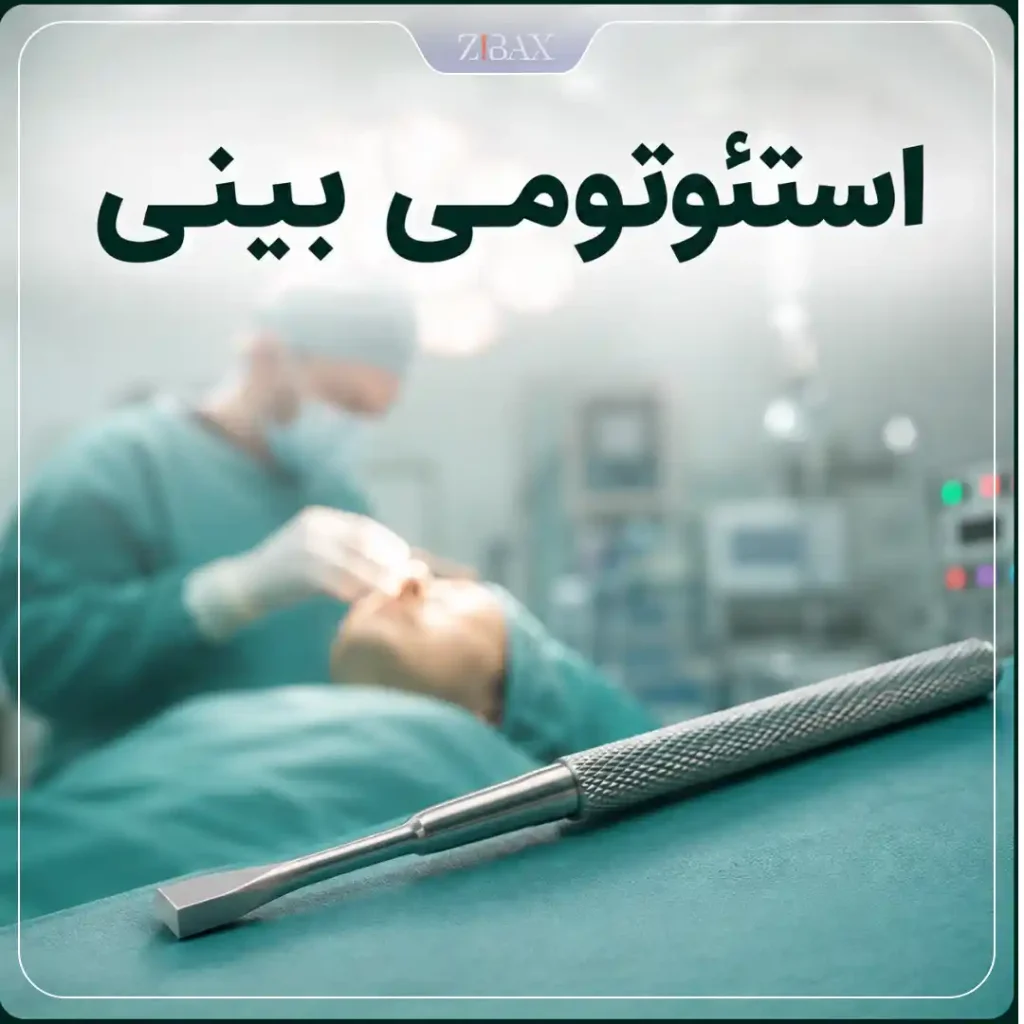 استئوتومی بینی چیست
