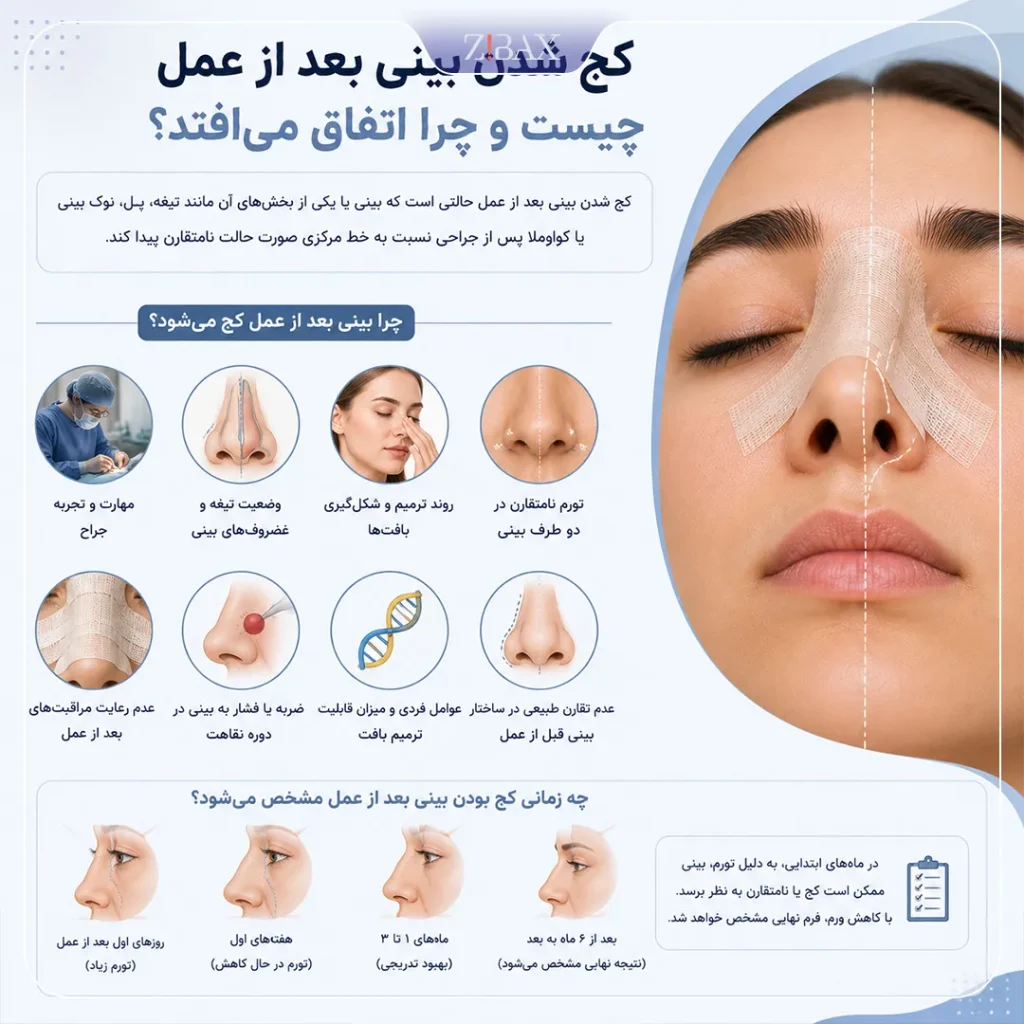 کج شدن بینی بعد از عمل چیست