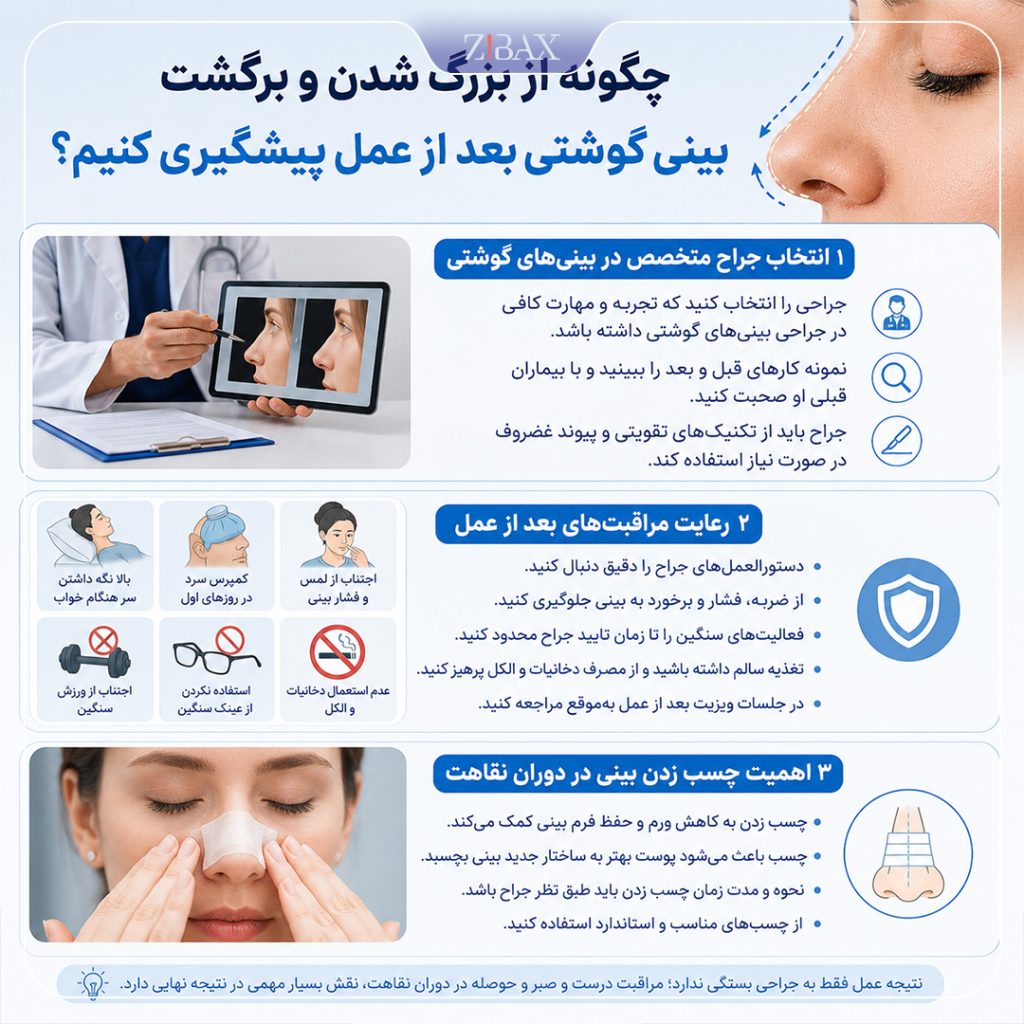 پیشگیری از بزرگ شدن بینی بعد از عمل